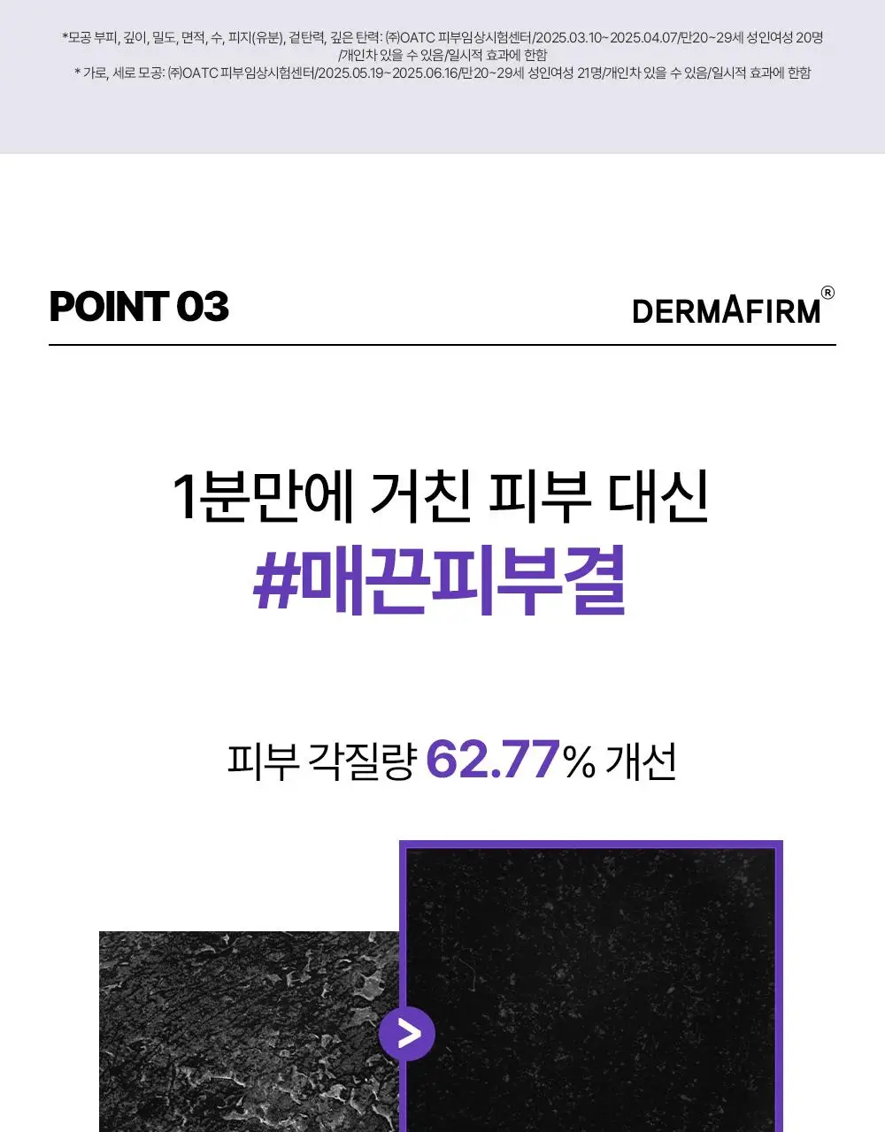 [나띠PICK][모공케어] 더마펌 펩트올로지 부스팅 앰플 레티노이드 30ml 기획 (+30ml 리필) 상세페이지 31